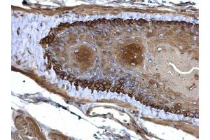 Immunohistochemistry (IHC) image for anti-Keratin 13 (KRT13) antibody (ABIN2856711)