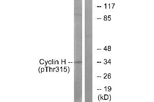 Western blot analysis of extracts from HeLa cells, using Cyclin H (Phospho-Thr315) antibody. (Cyclin H Antikörper  (pThr315))
