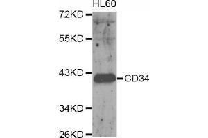 Western blot analysis of extracts of HL60 cell, using CD34 antibody. (CD34 Antikörper  (AA 32-290))