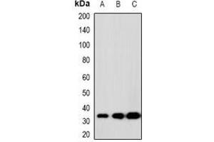 Western blot analysis of SCP3 expression in K562 (A), 22RV1 (B), H480 (C) whole cell lysates. (SYCP3 Antikörper)