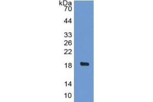 WB of Protein Standard: different control antibodies against Highly purified E. (BNP ELISA Kit)