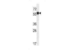 Western blot analysis in ZR-75-1 cell line lysates (35ug/lane). (C6ORF211 Antikörper  (N-Term))