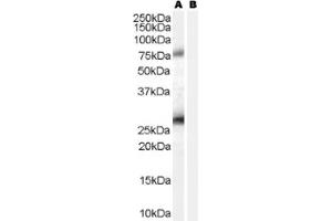 Image no. 1 for anti-Estrogen Receptor Binding Site Associated, Antigen, 9 (EBAG9) (C-Term) antibody (ABIN374701)