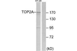 Western Blotting (WB) image for anti-Topoisomerase (DNA) II alpha 170kDa (TOP2A) (N-Term) antibody (ABIN1849153) (Topoisomerase II alpha Antikörper  (N-Term))
