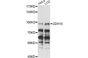Western blot analysis of extracts of various cell lines, using CDH19 antibody (ABIN6291652) at 1:1000 dilution. (CDH19 Antikörper)