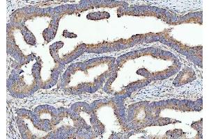 IHC analysis of SPATA18 using anti-SPATA18 antibody (ABIN7601020). (SPATA18 Antikörper  (AA 27-490))