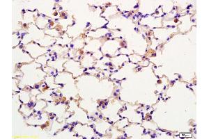 Formalin-fixed and paraffin embedded rat lung labeled with Anti-SPON1/F spondin Polyclonal Antibody, Unconjugated (ABIN873225) at 1:200 followed by conjugation to the secondary antibody and DAB staining. (SPON1 Antikörper  (AA 741-807))