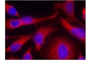 Image no. 1 for anti-Protein Kinase D1 (PRKD1) (pSer738) antibody (ABIN196754) (PKC mu Antikörper  (pSer738))