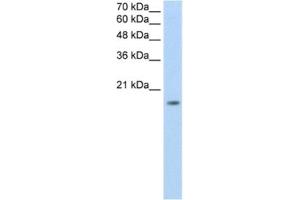 Western Blotting (WB) image for anti-Zinc Finger Protein 580 (ZNF580) antibody (ABIN2461874) (ZNF580 Antikörper)