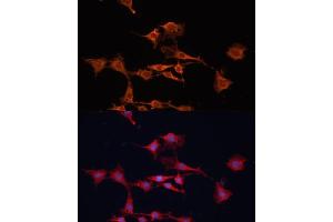 Immunofluorescence analysis of C6 cells using GSTM3 antibody (ABIN6131967, ABIN6141470, ABIN6141471 and ABIN6223605) at dilution of 1:100. (GSTM3 Antikörper  (AA 101-225))