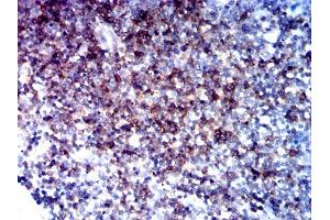 Immunohistochemical analysis of paraffin-embedded tonsil tissues using CD5 mouse mAb with DAB staining. (CD5 Antikörper  (AA 403-495))