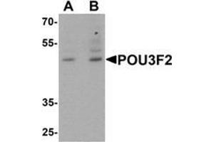 Western blot analysis of POU3F2 in 3T3 cell lysate with POU3F2 antibody at (A) 1 and (B) 2 μg/mL. (POU3F2 Antikörper  (C-Term))