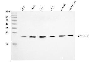 Western blot analysis of RNF212 using anti-RNF212 antibody (ABIN7599812).