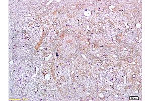Formalin-fixed and paraffin embedded rat brain tissue labeled with Anti-IL-18 Polyclonal Antibody (ABIN669696), Unconjugated at 1:200, followed by conjugation to the secondary antibody and DAB staining (IL-18 Antikörper)