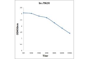 Antigen: 0. (ANKRD11 Antikörper  (AA 731-820))