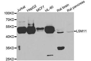 LSM11 Antikörper  (AA 131-360)