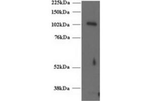 Image no. 1 for anti-Unc-13 Homolog D (UNC13D) (C-Term) antibody (ABIN374437) (UNC13D Antikörper  (C-Term))