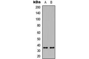 Western blot analysis of ICER expression in HeLa (A), Raw264. (CREM Antikörper  (Center))