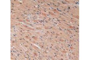 IHC-P analysis of Mouse Heart Tissue, with DAB staining. (VEGFC Antikörper  (AA 108-223))
