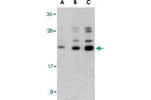 Western blot analysis of CASP6 in Jurkat cell lysate with CASP6 polyclonal antibody  at (A) 0.