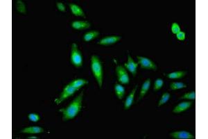 Immunofluorescent analysis of Hela cells using ABIN7153665 at dilution of 1:100 and Alexa Fluor 488-congugated AffiniPure Goat Anti-Rabbit IgG(H+L) (Non-Syndromic Hearing Impairment Protein 5 (GSDME) (AA 1-496) Antikörper)