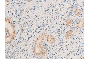 Immunohistochemistry (IHC) image for anti-Baculoviral IAP Repeat-Containing 5 (BIRC5) (pThr117) antibody (ABIN6255588)