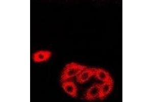 Immunofluorescent analysis of HAPLN1 staining in Hela cells.