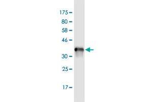 Western Blot detection against Immunogen (35. (ADNP Antikörper  (AA 1018-1102))