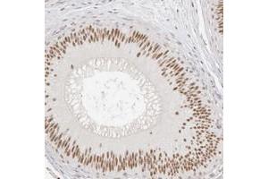 Immunohistochemical staining of human epididymis with LARP7 polyclonal antibody  shows nuclear positivity in glandular cells at 1:20-1:50 dilution. (LARP7 Antikörper)