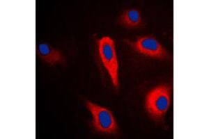 Immunofluorescent analysis of Cytokeratin 16 staining in HeLa cells. (KRT16 Antikörper  (C-Term))