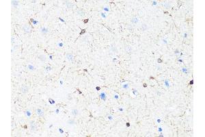 Immunohistochemistry of paraffin-embedded rat brain using TH Antibody (ABIN5974878) at dilution of 1/100 (40x lens). (TH Antikörper)