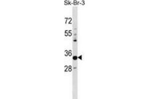 Western blot analysis in SK-BR-3 cell line lysates (35ug/lane) using PHYHD1 Antibody .