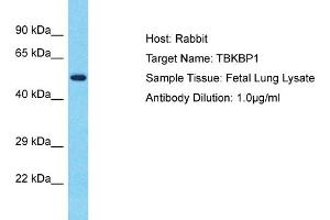 Host: Rabbit Target Name: TBKBP1 Sample Type: Fetal Lung lysates Antibody Dilution: 1. (TBKBP1 Antikörper  (N-Term))