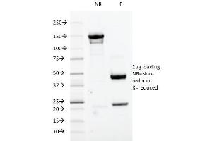 SDS-PAGE Analysis Purified Cdk1 Mouse Monoclonal Antibody (A17. (CDK1 Antikörper  (C-Term))