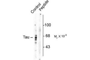 Image no. 1 for anti-Microtubule-Associated Protein tau (MAPT) (pSer416) antibody (ABIN372727) (MAPT Antikörper  (pSer416))