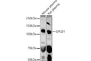 Western blot analysis of extracts of various cell lines, using GPLD1 antibody (ABIN6131716, ABIN6141335, ABIN6141336 and ABIN6222300) at 1:1000 dilution. (GPLD1 Antikörper  (AA 24-160))