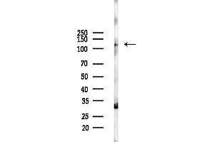 Western blot analysis of lysates from Rat lung, using SFRS14 Antibody at 1/1000 dilution.