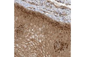 Immunohistochemical staining of human esophagus with NAF1 polyclonal antibody  shows strong nuclear and cytoplasmic positivity in squamous epithelial cells at 1:50-1:200 dilution. (NAF1 Antikörper)