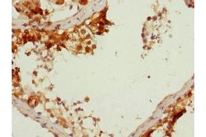 Immunohistochemistry of paraffin-embedded human testis tissue using ABIN7149639 at dilution of 1:100 (DAZ2 Antikörper  (AA 1-200))