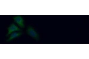 Detection of PKLR in Human HepG2 cell using Polyclonal Antibody to Pyruvate kinase isozymes R/L (PKLR) (PKLR Antikörper  (AA 219-420))
