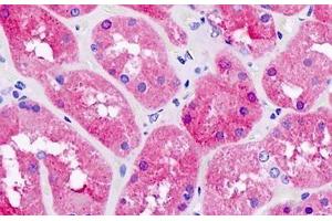 anti-Pyridoxamine 5'-Phosphate Oxidase (PNPO) antibody