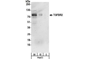 Western Blotting (WB) image for anti-Transforming Growth Factor, beta Receptor II (70/80kDa) (TGFBR2) (AA 517-567) antibody (ABIN7453281)