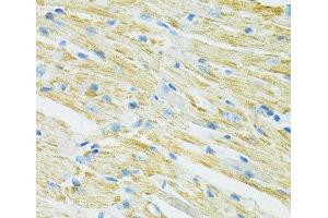 Immunohistochemistry of paraffin-embedded Mouse heart using SLC19A1 Polyclonal Antibody at dilution of 1:100 (40x lens). (SLC19A1 Antikörper)