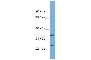 WB Suggested Anti-PDP2 Antibody Titration: 0. (PDP2 Antikörper  (Middle Region))