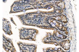 ABIN6264656 and ABIN6279714 at 1/100 staining Mouse colorectal tissue by IHC-P.
