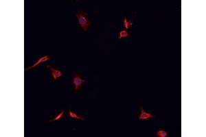 ABIN6266799 staining K562  cells by IF/ICC. (TACC1 Antikörper  (N-Term))