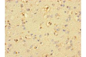 Immunohistochemistry of paraffin-embedded human brain tissue using ABIN7169856 at dilution of 1:100 (SMIM19 Antikörper  (AA 44-107))