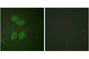 Immunofluorescence analysis of HeLa cells, using Amyloid beta A4 (Ab-743/668) Antibody. (APP Antikörper  (AA 711-760))