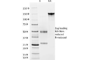 SDS-PAGE Analysis Purified CD4 Mouse Monoclonal Antibody (C4/206). (CD4 Antikörper)