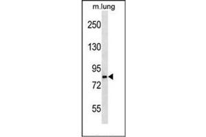 Western Blotting (WB) image for anti-Leucine Rich Repeat and Sterile alpha Motif Containing 1 (LRSAM1) (AA 1-30), (N-Term) antibody (ABIN953239)